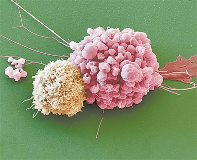 世纪官网：揭秘癌细胞与神经元的“共生共舞”